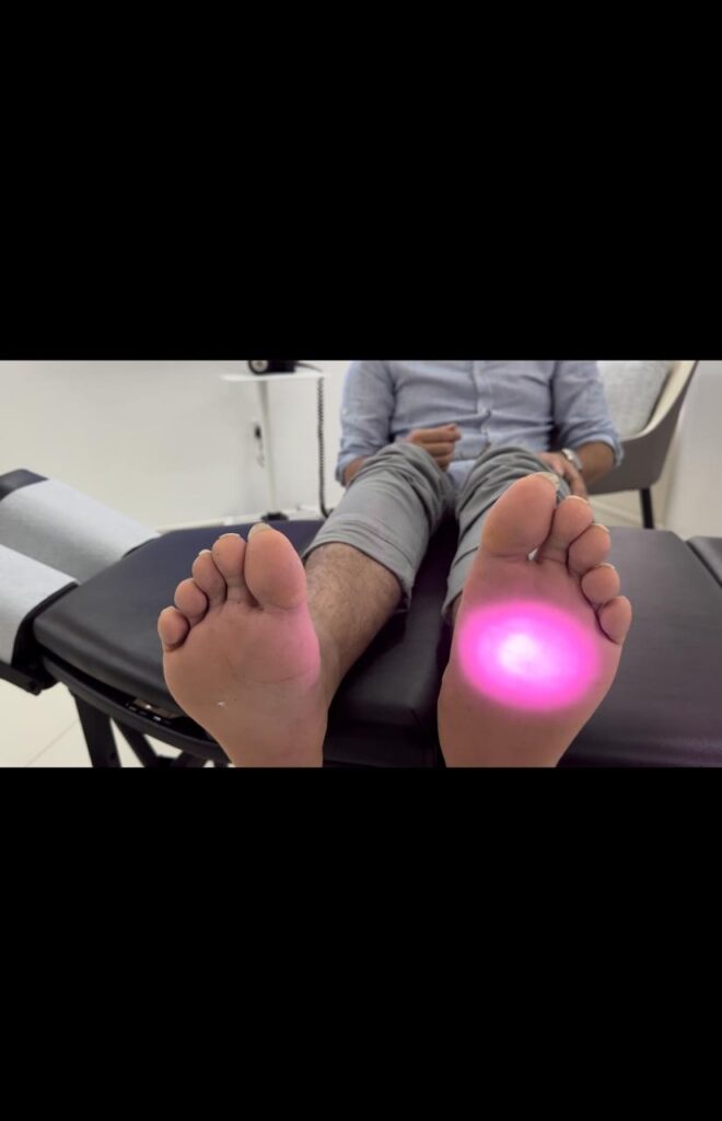 Laser Treatment