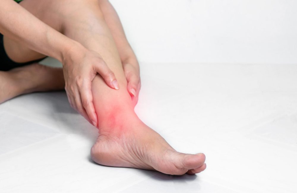 Plantar Fasciitis